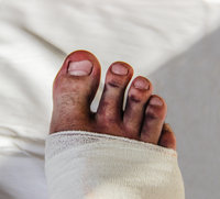 DasBlue-toe-Phänomen