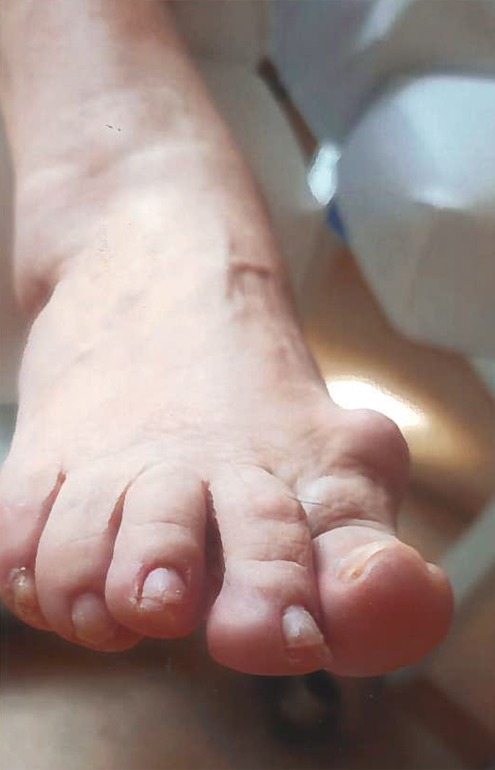 Abb2