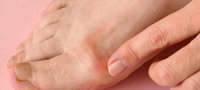 Behandlung von Patienten mit einem Erysipel (Wundrose)