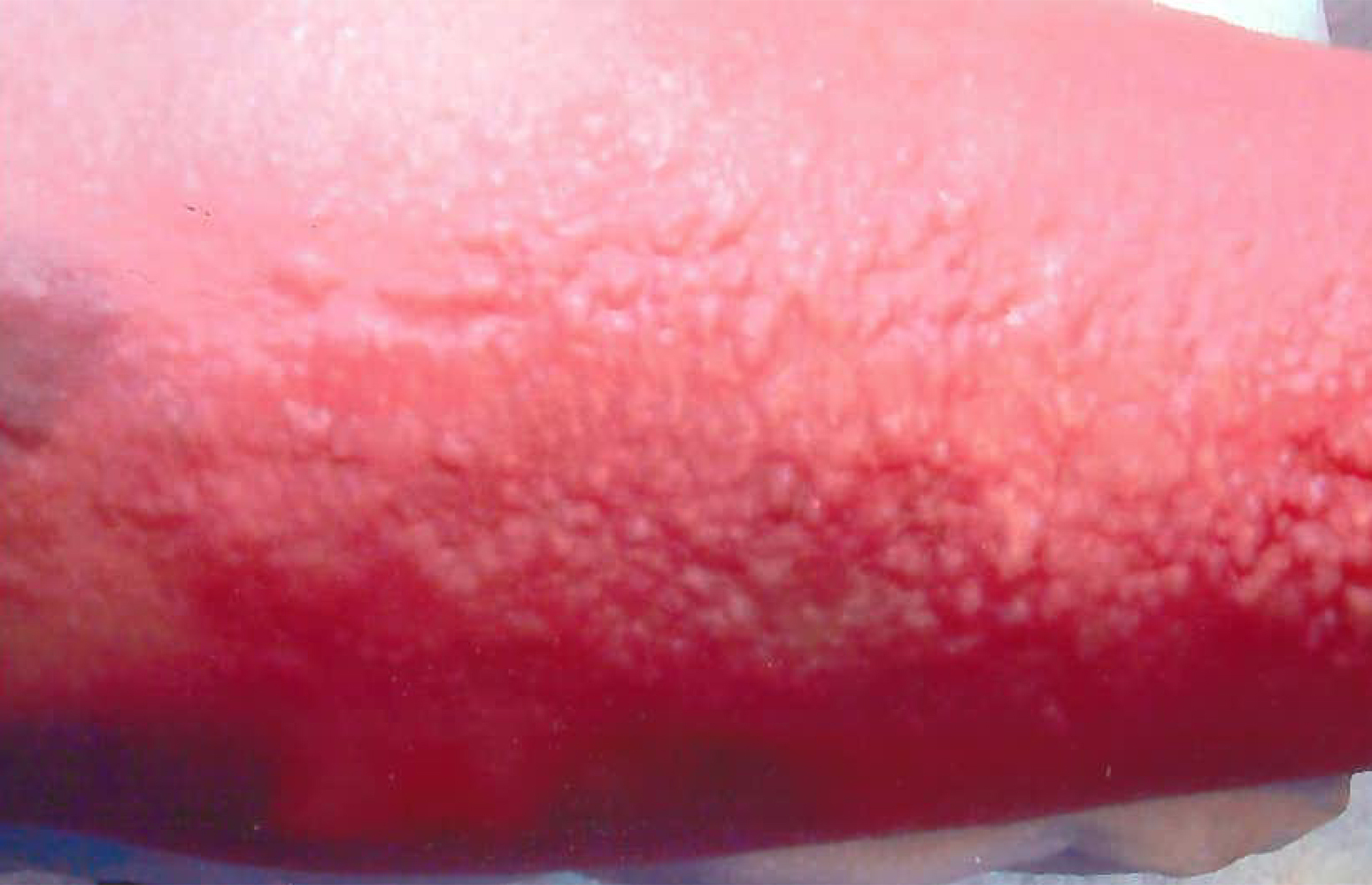 Abb1c