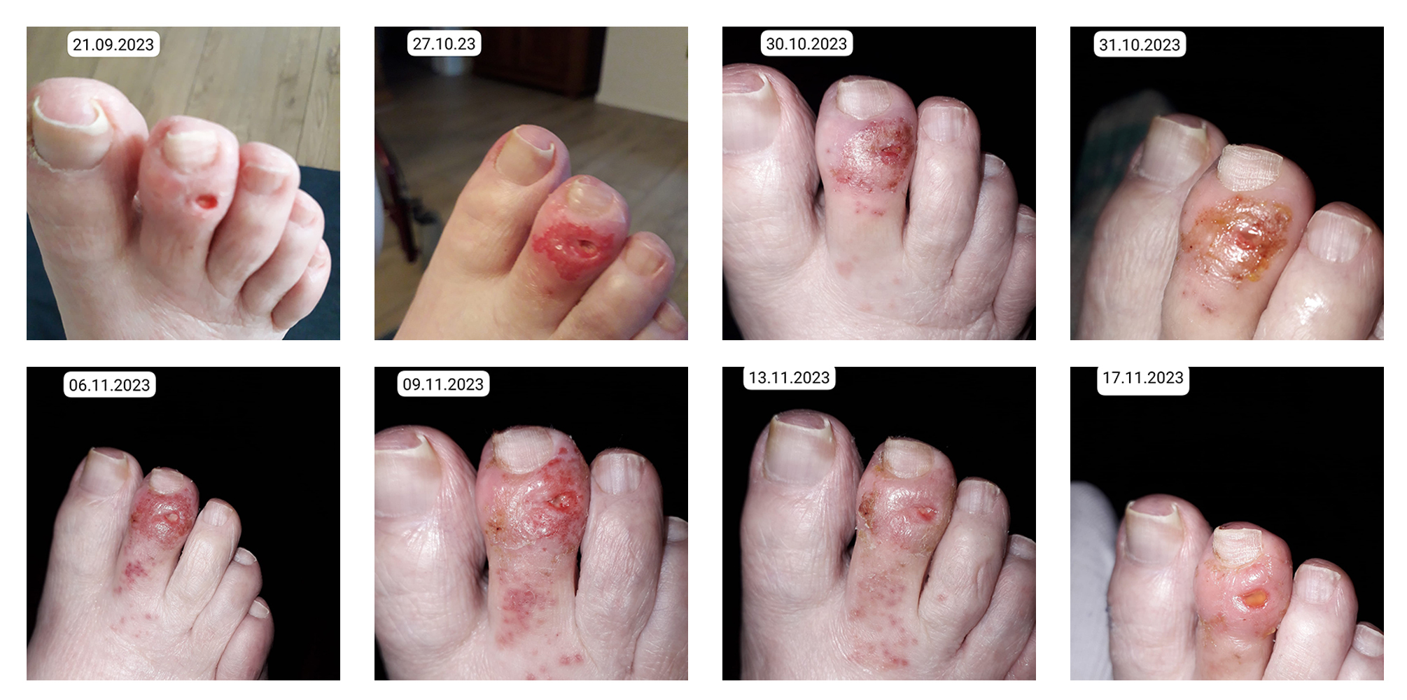 Bilder1