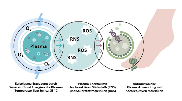 Bild_Kaltplasma in der Podologie
