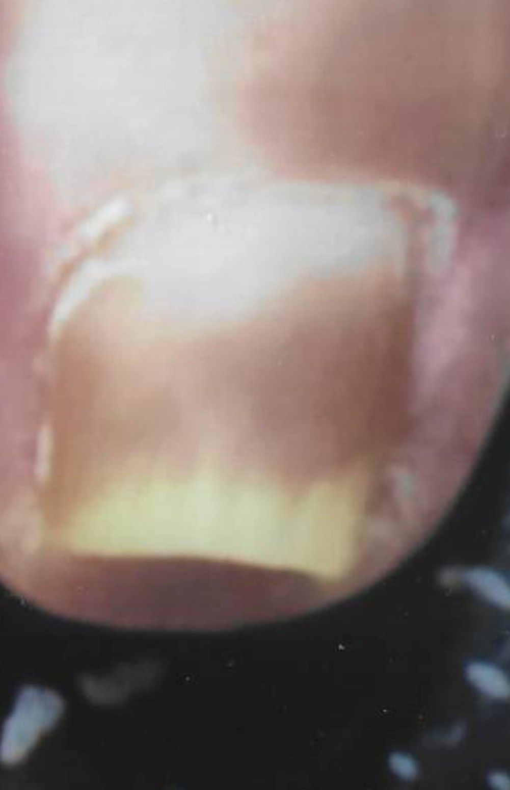 Bild2b